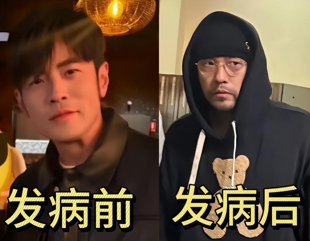 钱再多有什么用！46岁周杰伦现状曝光！病情严重到走路需要人搀扶